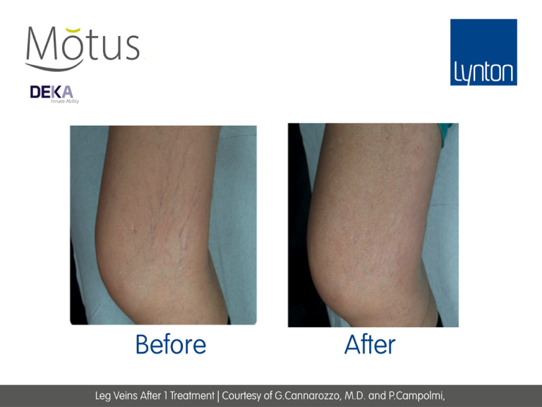 Thread-Veins---Motus-Moveo